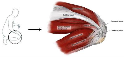 Deep peroneal neuropathy induced by prolonged squatting: a case report